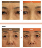 Wrinkle Power Filling
