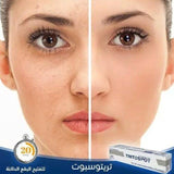 كريم تريتوسبوت tritospot لعلاج اسمرار الجلد